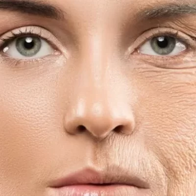 anti-aging