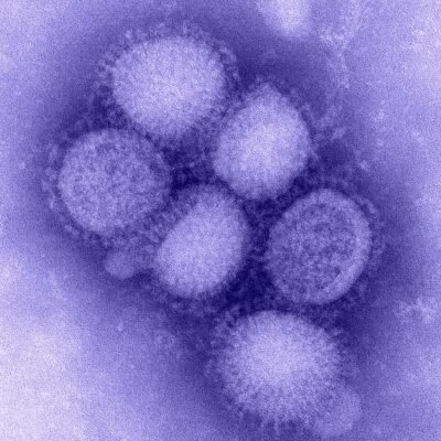 H3N2 Virus